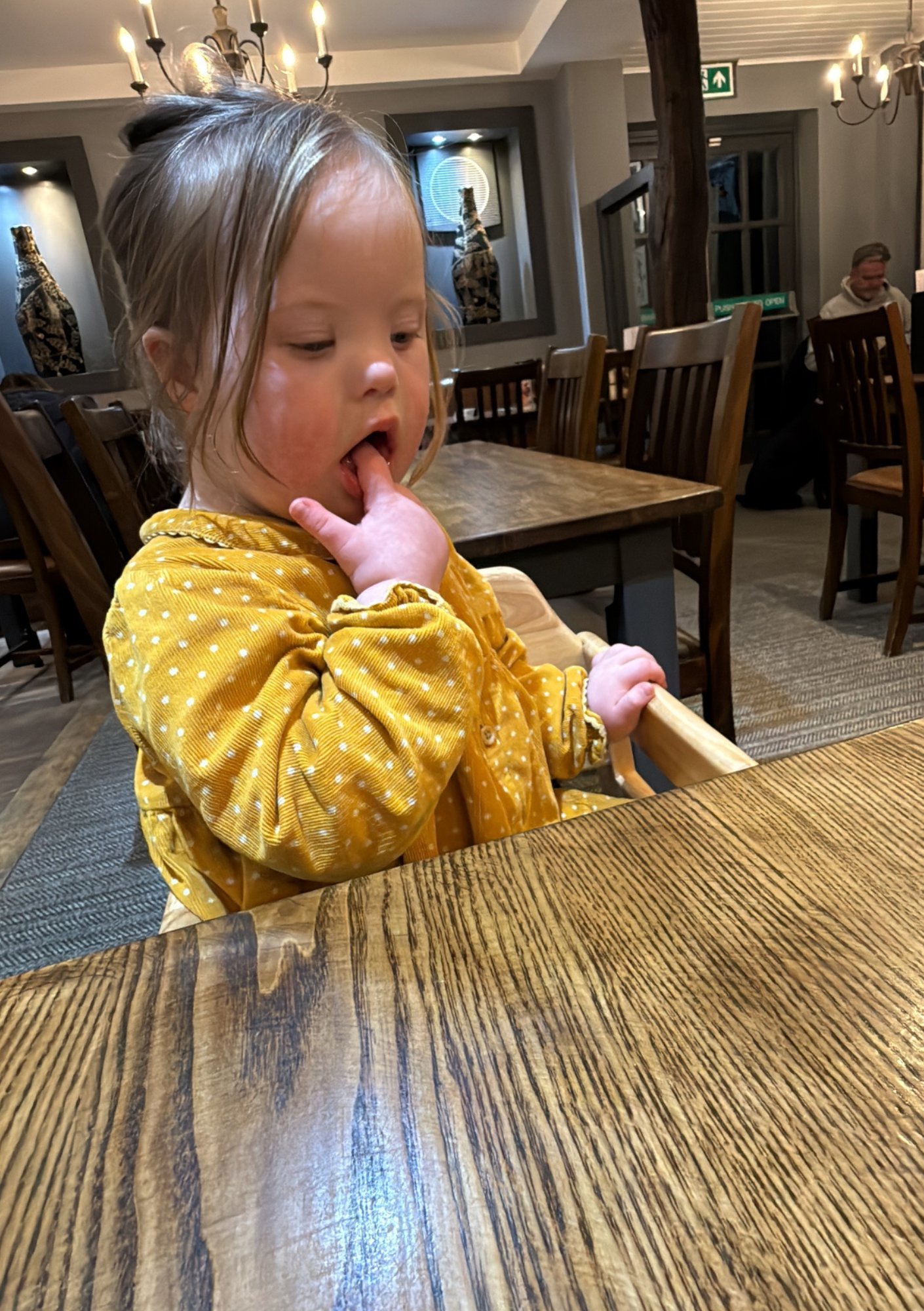 Child with Down syndrome exploring finger movements during feeding, showing early fine motor skills and oral motor development